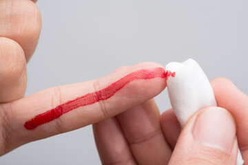 Use a cotton wool to wipe the blood at the wound on fingertips that are bleeding.