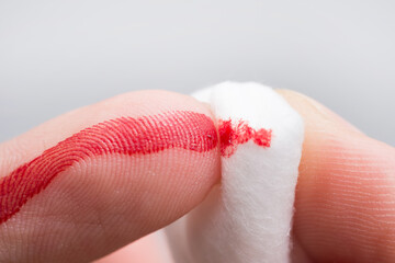 Fototapeta premium Use a cotton wool to wipe the blood at the wound on fingertips that are bleeding.