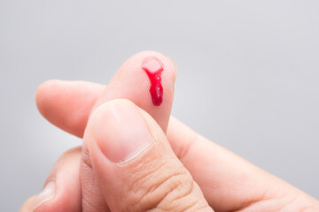 Bleeding blood from the cut finger wound. Injured finger with bleeding open cut wound. Closeup of...