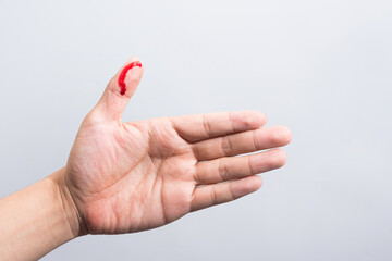Bleeding blood from the cut finger wound. Injured finger with bleeding open cut wound. Closeup of...