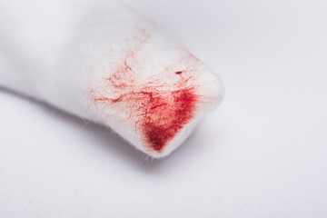 A cotton wool swab with blood stains after use, from cleansing the bleeding wound on a white background.