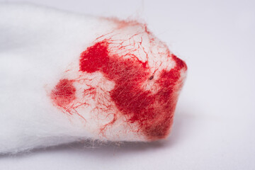 A cotton wool swab with blood stains after use, from cleansing the bleeding wound on a white background.