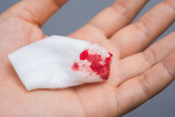 Hands are carrying a cotton swab with blood stains after use, from cleansing the bleeding wound on a white background.