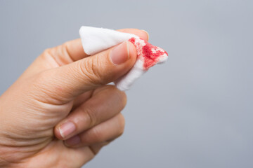 Hands are carrying a cotton swab with blood stains after use, from cleansing the bleeding wound on a white background.