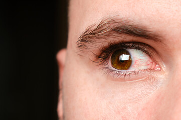 Close up mans bloodshot or red eyes on a black background, caused by conjunctivitis, allergy or tiredness . Concept of healthcare with copy space