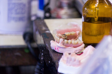 dental prosthesis mold on a table rio de janeiro.
