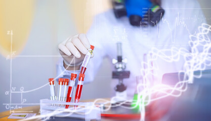 Background researcher in the laboratory is testing drugs for the treatment of viral pneumonia. Coronovirus blood test of infected patients. World pandemic.