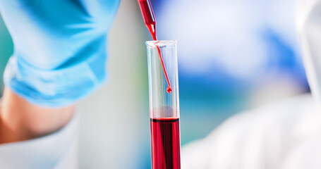 medical worker take test tube