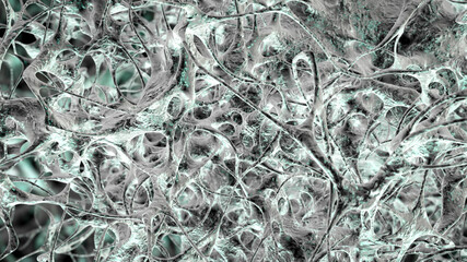 Osteoporotic trabecular bone