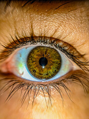 Olho Colorido