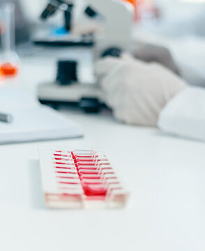 blurry image of a desktop in a medical laboratory.