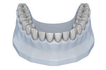 Wax-up teeth model. Treatment Planning. Medically accurate tooth 3D illustration