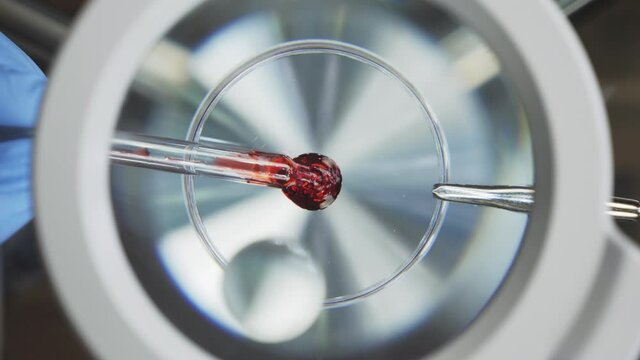 Drop of blood under the microscope, vaccine research. A scientist conducts a blood test for a virus. Close-up view from above