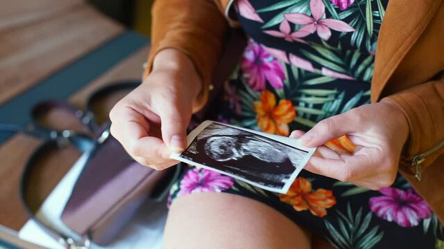 A woman holds a photograph of an embryo in her hands. Expectation of the planned pregnancy. Planned ultrasound examination of a woman's embryo.
