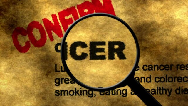 Magnifying glass on cancer text  search concept