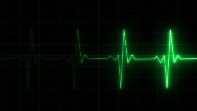 Heart Rate Monitor Electrocardiogram Ekg Or Ecg Looping background