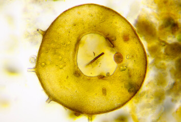 Microscopic view of testate amoeba (Centropyxis aculeata) shell. Brightfield illumination. - obrazy, fototapety, plakaty