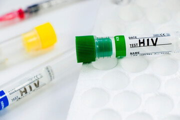 Hiv and aids infection test, doctors face and hand holding tube with blood on the blue background.