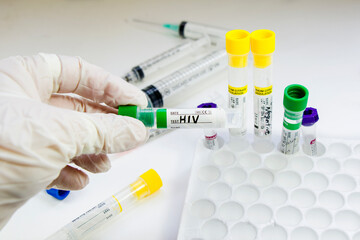 Hiv and aids infection test, doctors face and hand holding tube with blood on the blue background.