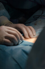 surgeon working in operating room