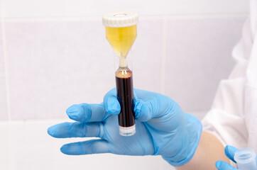 doctor holding a blood test tube