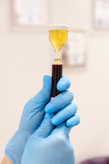hand holding a blood test tube