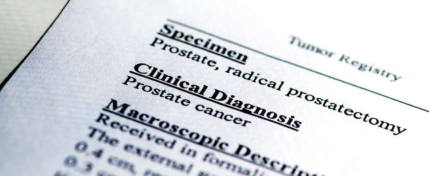 Diagnosis Prostate Cancer: Report heading indicating surgically removed prostate was cancerous.
