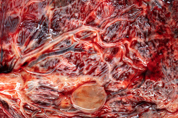 Placenta Organ