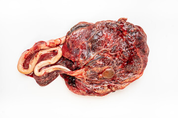 Obraz premium Placenta Organ