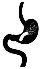 stomach and bacterium Helicobacter