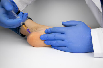 An orthopedic surgeon gives an injection in the heel to relieve pain from a heel spur. The concept...