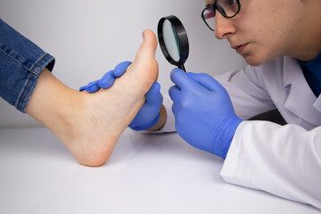 A trichologist examines a toenail with a magnifying glass, which is affected by the fungus....