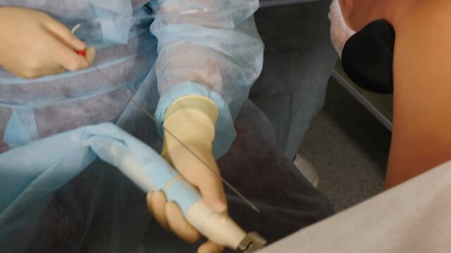 Gynecological surgery, Close-up shot of gynecologist performing operation using monitoring ultrasound machine IVF follicular puncture for oocyte retrieval. Close-up. 4 k video