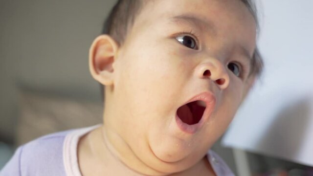 portrait of asian baby with skin rashes from allergies or irritation and itchy