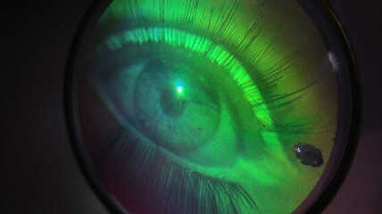 green eye lens