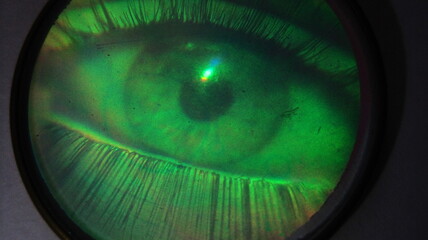 green eye lens