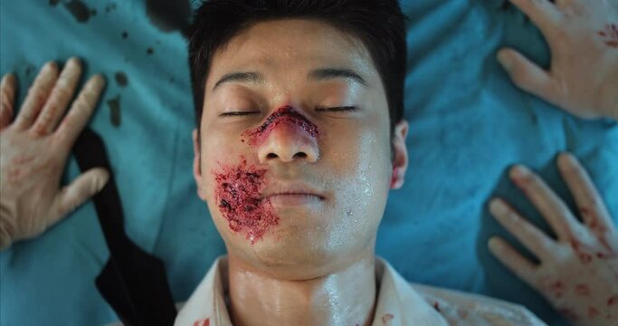 Close up of injured asian guy lying on medical transportation cart opening and closing eyes in ambulance. Top view of man with blood and head wound riding with paramedics to hospital