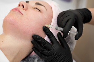 Close-up of cosmetologist makes the Rejuvenating facial injections procedure for tightening on the face skin of woman in a beauty clinic. Biorevitalization procedure