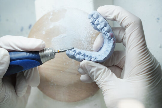 From above of crop anonymous dentist in medical gloves grinding dental prosthesis with professional tool while working in modern laboratory