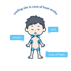 It is an illustration showing the cooling site when there is a suspicion of heat stroke. Vector image.