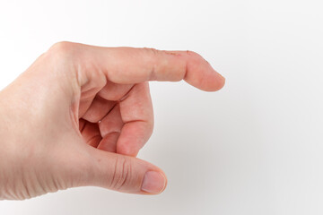 cut index finger with a extensor tendon injury, mallet finger wound, tip of the finger unable to...