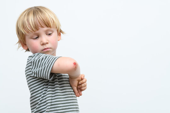 boy kid arm accident wound he painful abrasion scratches from fall, medical health concept