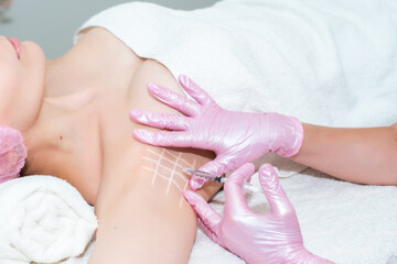 Hyperhidrosis treatment. in the office, the beautician makes an injection of women in the armpit.stop sweating and smell