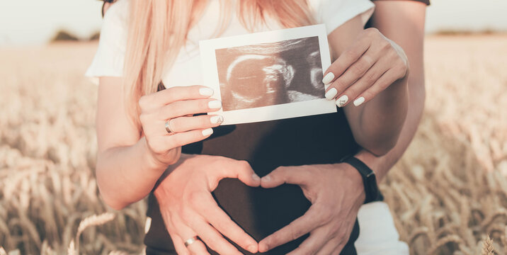 A married couple who are expecting a baby holding an ultrasound scan