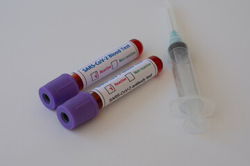 Syringe and blood sample tubes for Coronavirus COVID-19 virus or SARS-CoV-2, reactive result.