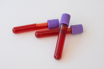 Test tubes with blood samples isolated on white background.