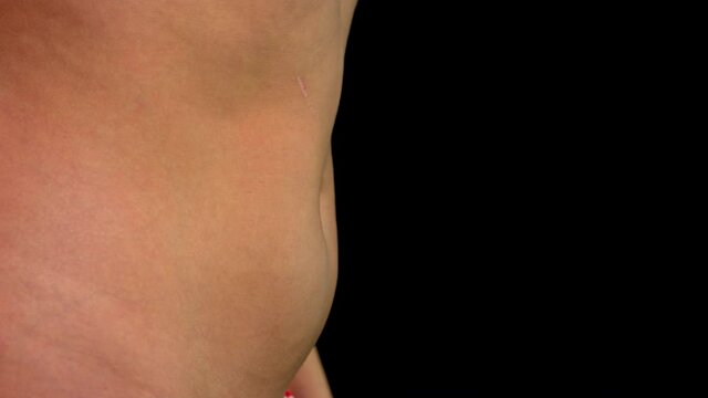 Close up of a naked woman's belly squeezing excess fat on her belly.