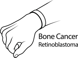 A hand with a cause bracelet. White, Bone Cancer, Retinoblastoma.