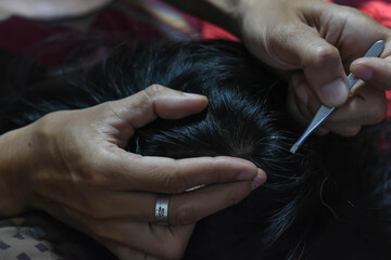 A hand took a tweezer to pluck out the gray hair from the head