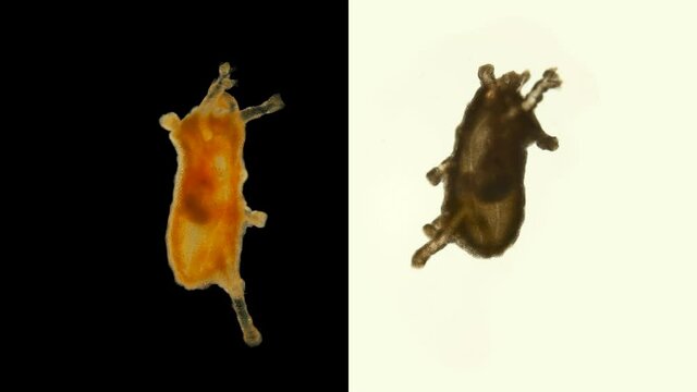 Pentacula Holothuroidea larva, Juvenile sea cucumber under microscope, type Echinodermata, a very unusual organism, at this stage, she sank to bottom and crawled in search of food. Barents Sea